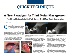 Third Molar Management article